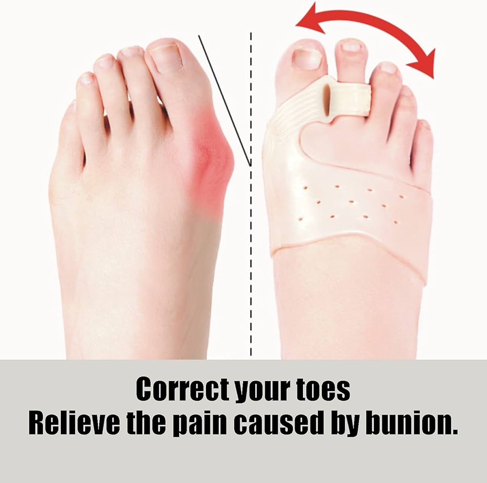 Juanetero Suave de Silicona 🦶✔️